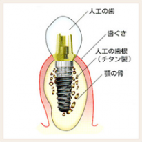 記事画像