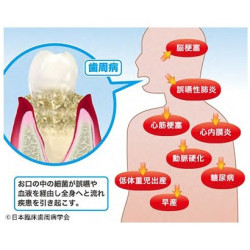 記事画像