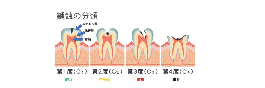 記事画像