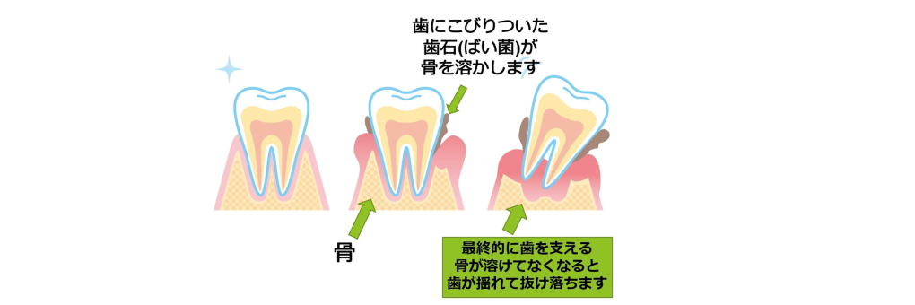 記事画像