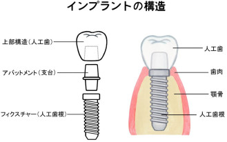 記事画像